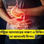 গ্যাস্ট্রিক আলসারের লক্ষণ ও চিকিৎসা