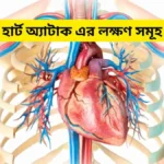 হার্ট অ্যাটাক এর লক্ষণ সমূহ। হার্ট অ্যাটাক প্রতিরোধের উপায়।